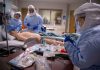 Los retos de la epidemiología ante las enfermedades crónicas Epidemiología enfermedades crónicas
