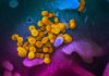 Sobre el aerotransporte del virus SARS-CoV-2